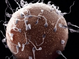 Ученые создали образцы спермы человека из клеток кожи