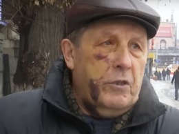Охотятся даже на женщин и детей: что случилось с украинской полицией