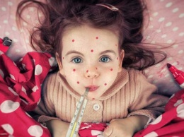 Вспышка кори в Украине: Почему массово болеют дети и как защититься от болезни