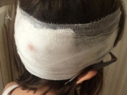 Громкий скандал в столичной школе: девочке с разбитой головой не вызвали «скорую»