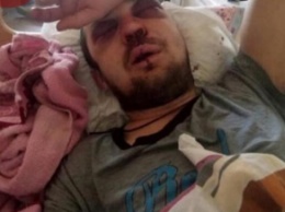 Водитель киевской маршрутки жестоко избил пассажира (фото)