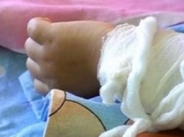 В Одессе спасают годовалого малыша, у которого обожжено 80% тела