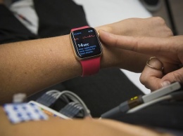 Как Apple Watch избегают ложных срабатываний при выявлении аритмии