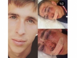В Михайловке велосипедист получил жуткие травмы, провалившись в яму (фото)
