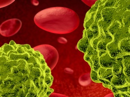 Ученые создали лазер для уничтожения раковых клеток крови
