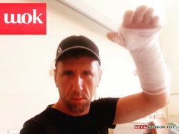Агрессивные высказывания пострадавшего от бродячих собак в Кривом Роге велосипедиста блокирует Фейсбук