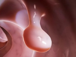 Ученые выяснили, как снизить риск полипов в кишечнике