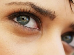 6 нарушений, о которых могут сигналить темные круги под глазами