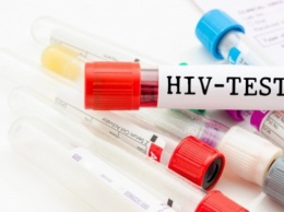 В Обухове на Киевщине сегодня все желающие могут бесплатно провериться на ВИЧ