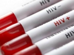Ученые рассказали о том, как ВИЧ приобретает устойчивость к лекарствам