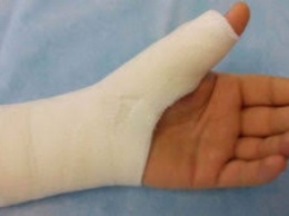 Житель Мелитополя сломал соседке палец