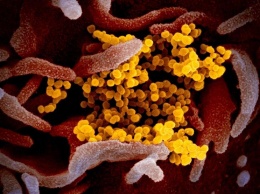 Ученые показали, как выглядит коронавирус COVID-19 под микроскопом (снимки)