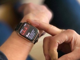 Что не так с Apple Watch