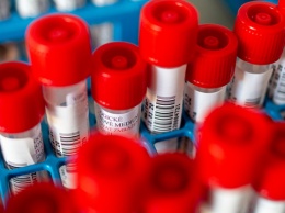 В Мелитополе главврач горбольницы заразился коронавирусом, 12 медиков на самоизоляции