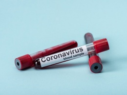 Где в Запорожье сделать тест на коронавирус и сколько это стоит