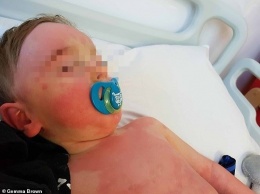 ''Сыпь почернела'': в Британии ребенка со страшными симптомами отказались тестировать на COVID-19