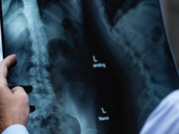 Криворожская инфекционная больница получила современный цифровой рентген - аппарат