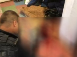 Стал между женщинами и получил ножевое ранение: на Днепропетровщине задержана женщина за нанесение телесных повреждений