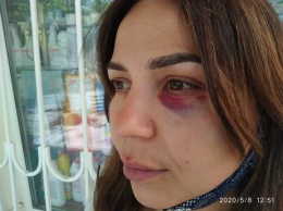 Тренер по ММА избил продавщицу в Крыму. Она требовала его надеть маску