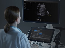 Intel AI улучшила технологию Samsung Medison для быстрого и точного УЗИ при беременности