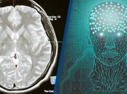 Ученые впервые в истории подключили человеческий мозг к компьютеру по беспроводной сети