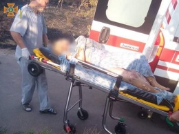 Сжигала мусор, вспыхнул сухостой, - на Николаевщине доставили в больницу женщину с тяжелыми ожогами