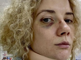 Актриса фильма «Стиляги» Инна Коляда заявила о жестком избиении