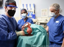 Человеку пересадили сердце свиньи. Что говорят ученые о результатах