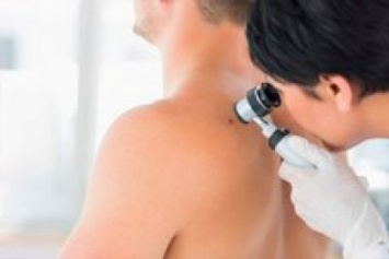 Енакиевцы смогут пройти бесплатное обследование на рак кожи