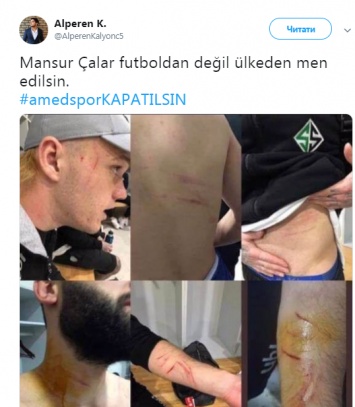 Футболист-курд вышел на поле с лезвием и порезал турецких игроков прямо во время матча