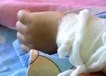 В Одессе спасают годовалого малыша, у которого обожжено 80% тела