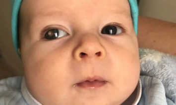 У двухмесячного Макара рак сетчатки глаза. На спасение ребенка есть только 2 недели