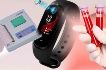 «В топку» Apple Watch - Xiaomi Mi Band 5 проведет ЭКГ и анализ крови