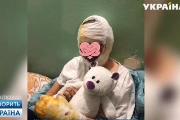 ''Глаза не открывались, как мумия'': стало известно, как отец изувечил 16-летнюю дочь в Черновцах