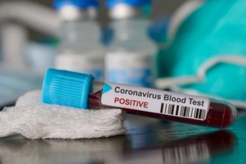 ''Работала до последнего'': франковчанка рассказала о массе контактов жертвы коронавируса