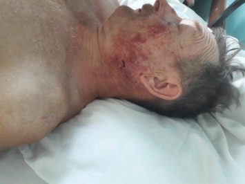 В Акимовском районе из-за черешни избили пенсионера