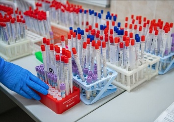 Где и сколько стоит: в каких лабораториях Харькова можно сдать ПЦР и ИФА тест на коронавирус