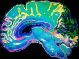 Глубокий сон после травмы головы может защитить мозг