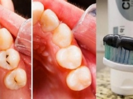 Новая зубная паста, которая оставит стоматологов без работы!