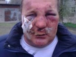 В Запорожской области избили члена одной из партий