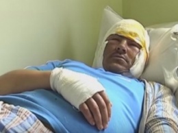 Пострадавший при взрыве в Новоалексеевке: Я ничего подобного никогда не видел (видео)