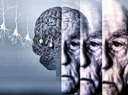 Ученые видят возможность лечения болезни Альцгеймера протеином