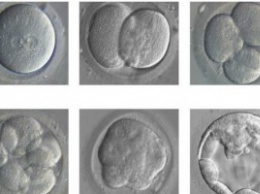 Ученые вырастили двухнедельный эмбрион человека