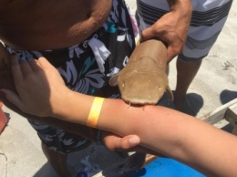 Американка попала в больницу с акулой, вцепившейся в руку (фото)