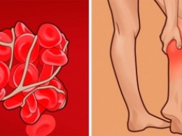 Признаки тромбов в кровеносных сосудах, и что делать, если вы их обнаружили