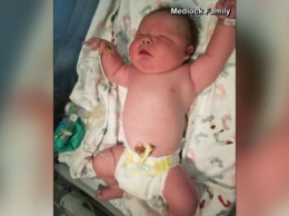 В Техасе родился 6-килограммовый ребенок. И это нечто!