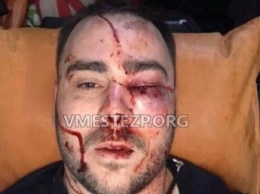 В Запорожье жестоко избили и прострелили ногу главе "Автоевросилы" (ФОТО)