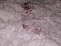 В Харькове мужчине оторвало кисть руки, когда он запускал фейерверки