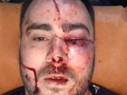 В Запорожье подстрелили и избили лидера организации "евробляхеров"