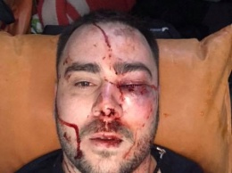 В Запорожье из-за замечания не бросать петарды под авто жестоко избили лидера местных евробляхеров